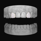 Diamond Lateral - Lateral - Bitez Grillz