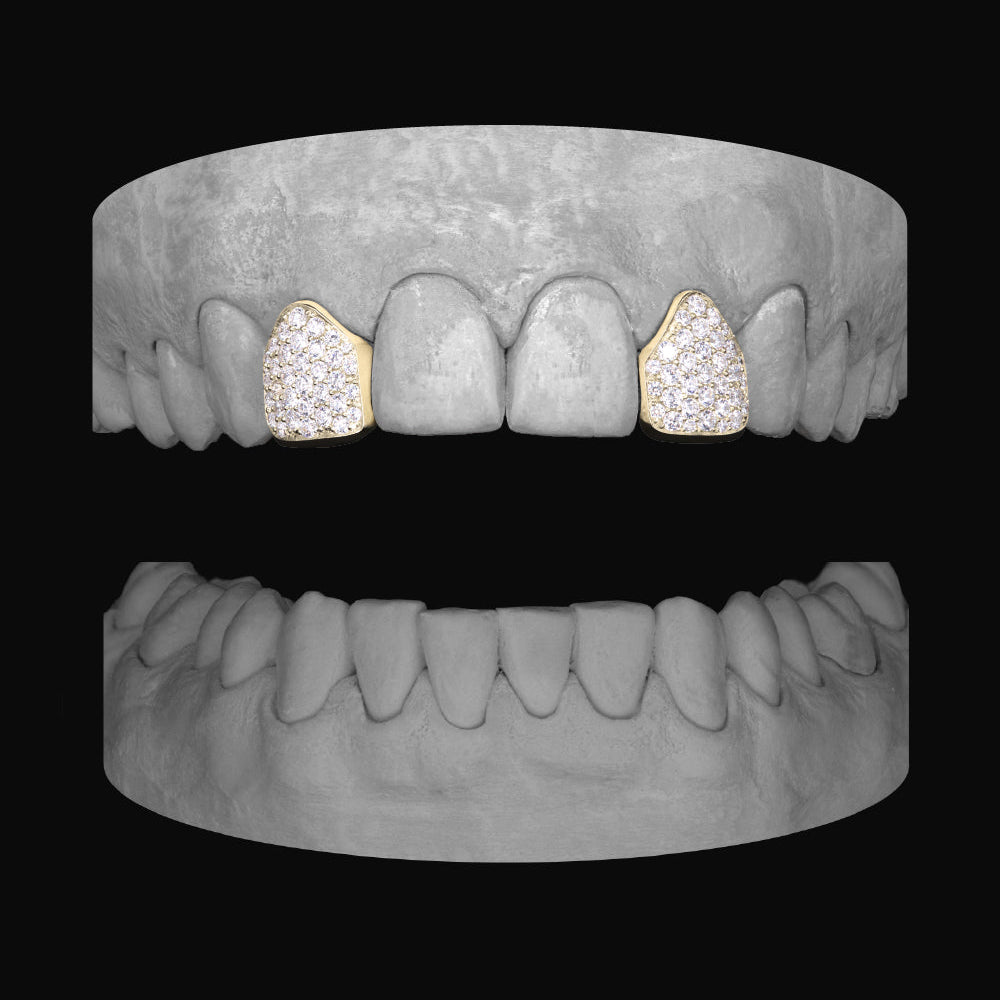 Diamond Lateral - Lateral - Bitez Grillz