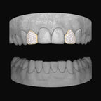 Diamond Lateral - Lateral - Bitez Grillz