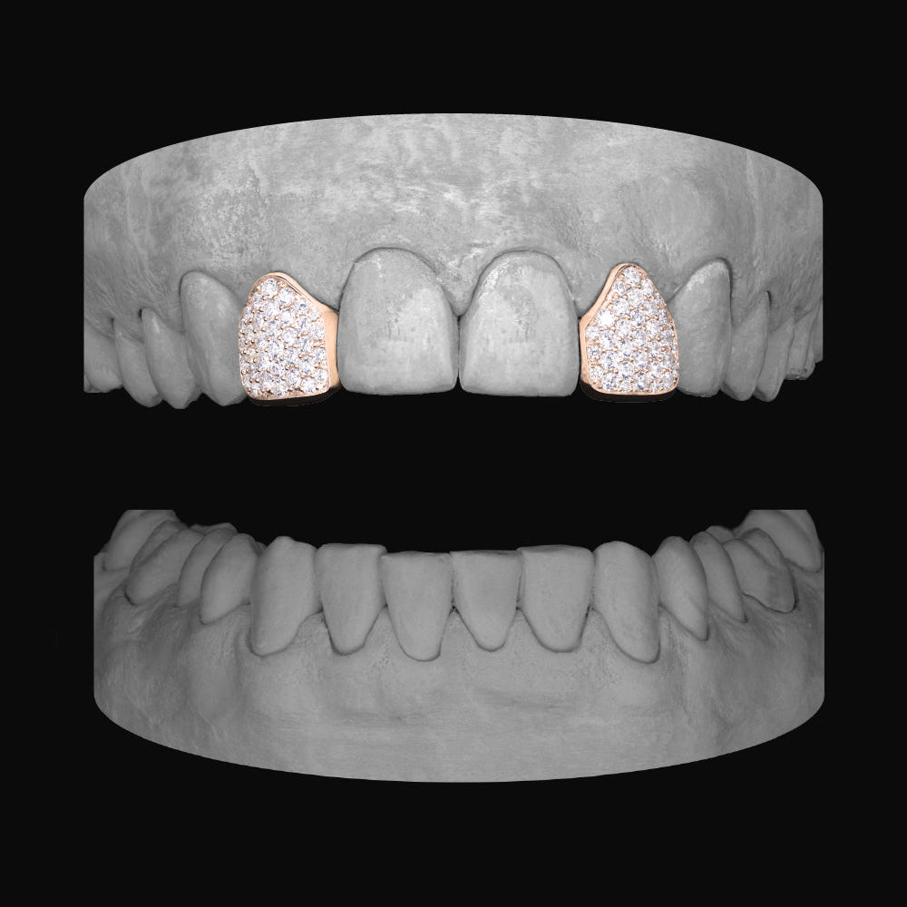 Diamond Lateral - Lateral - Bitez Grillz