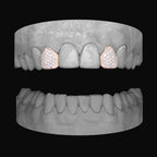 Diamond Lateral - Lateral - Bitez Grillz
