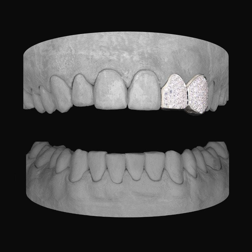 Diamond Lateral & Canine - Bitez Grillz