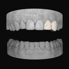 Diamond Lateral & Canine - Bitez Grillz