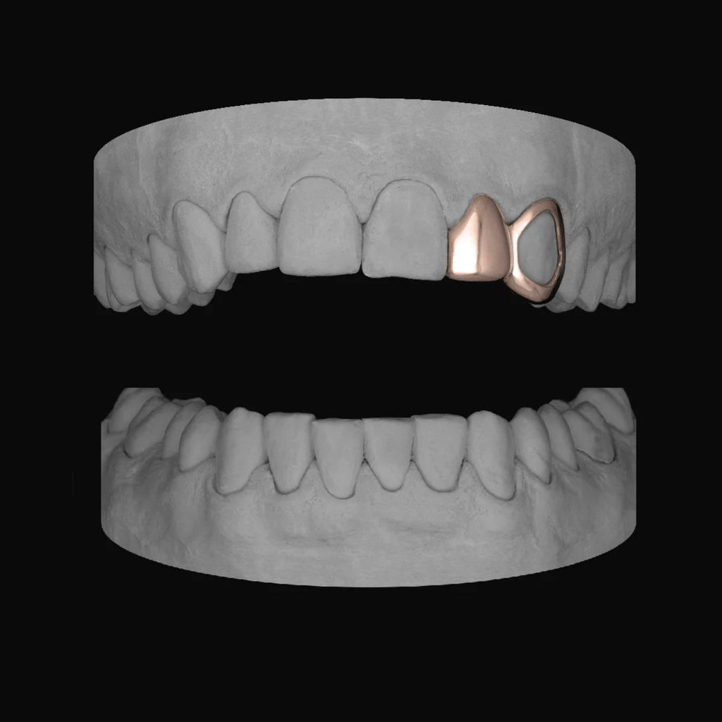 Lateral & Window Canine - Bitez Grillz