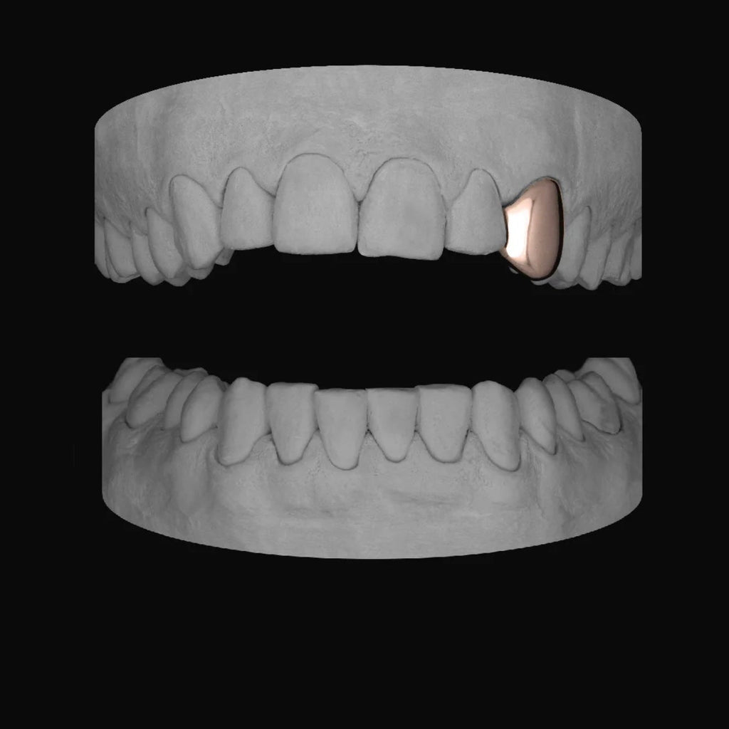 CANINE - Bitez Grillz