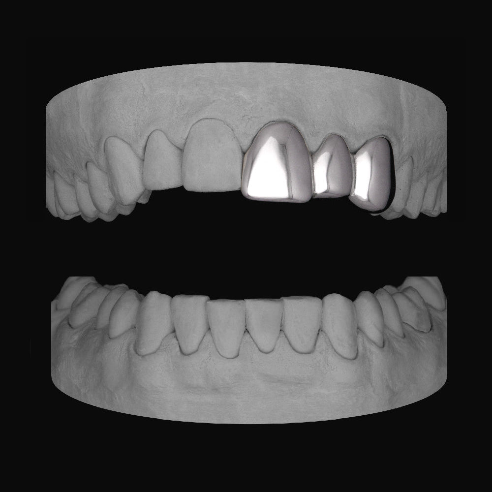 Front & Lateral & Canine - Bitez Grillz