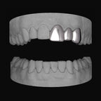 Front & Lateral & Canine - Bitez Grillz