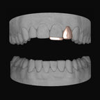 Lateral & Bar - Bitez Grillz