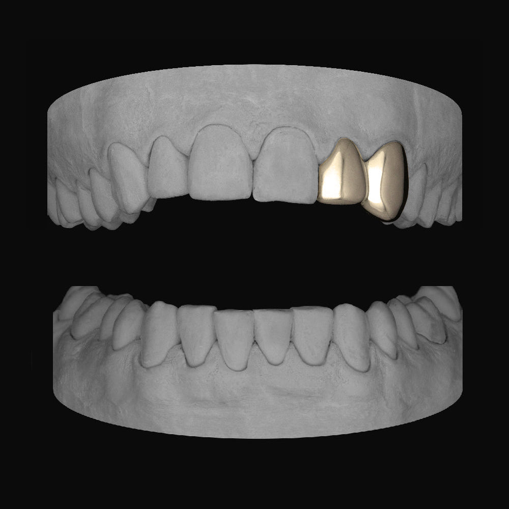 Lateral & Canine - Bitez Grillz