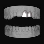 Front Tooth & Lateral - Bitez Grillz