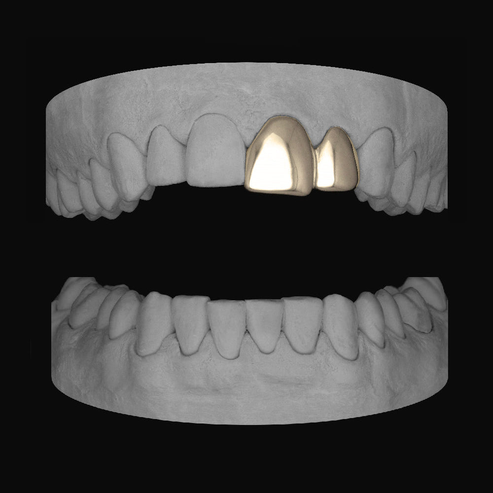 Front Tooth & Lateral - Bitez Grillz