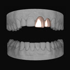 Front Tooth & Lateral - Bitez Grillz