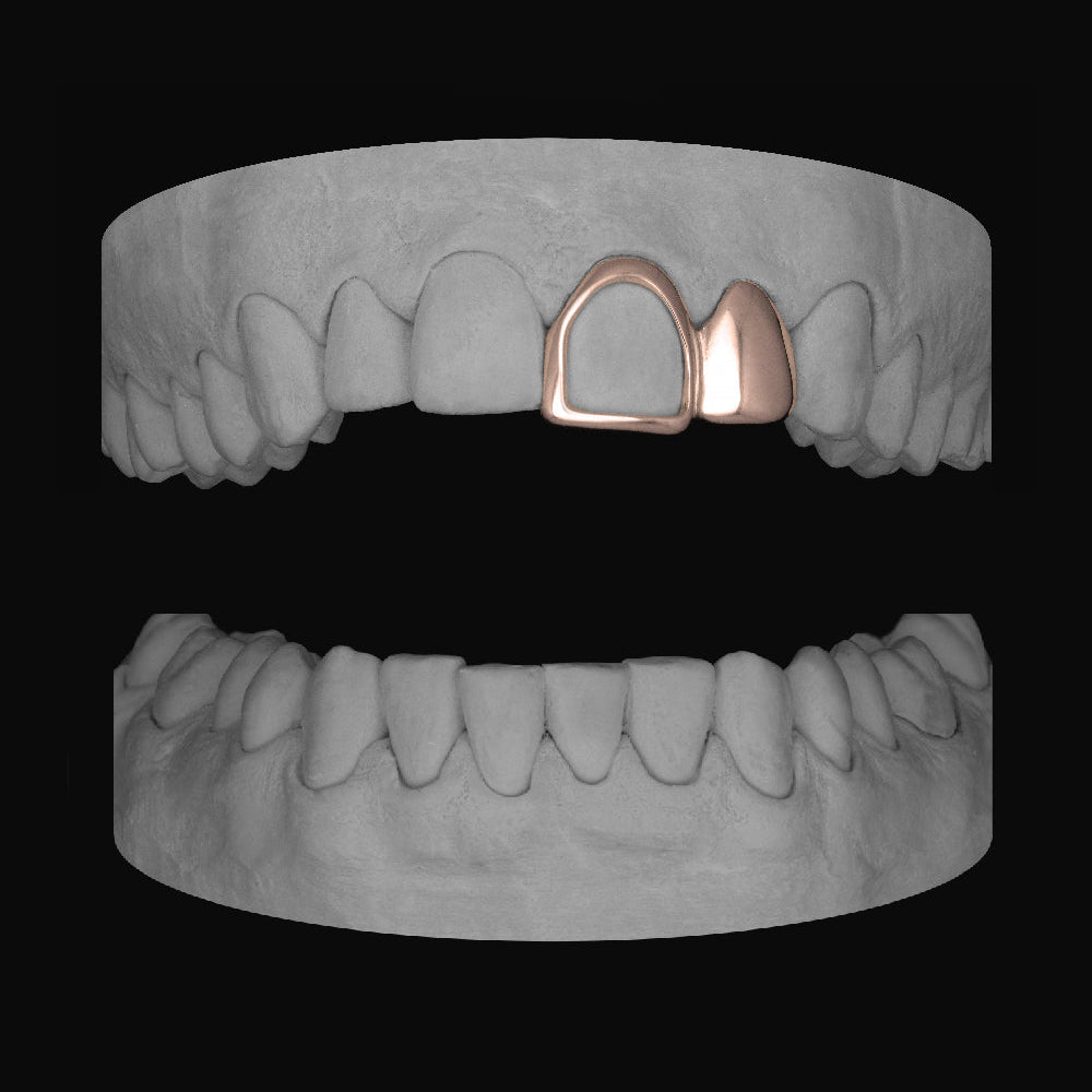 Lateral & Front Window - Bitez Grillz