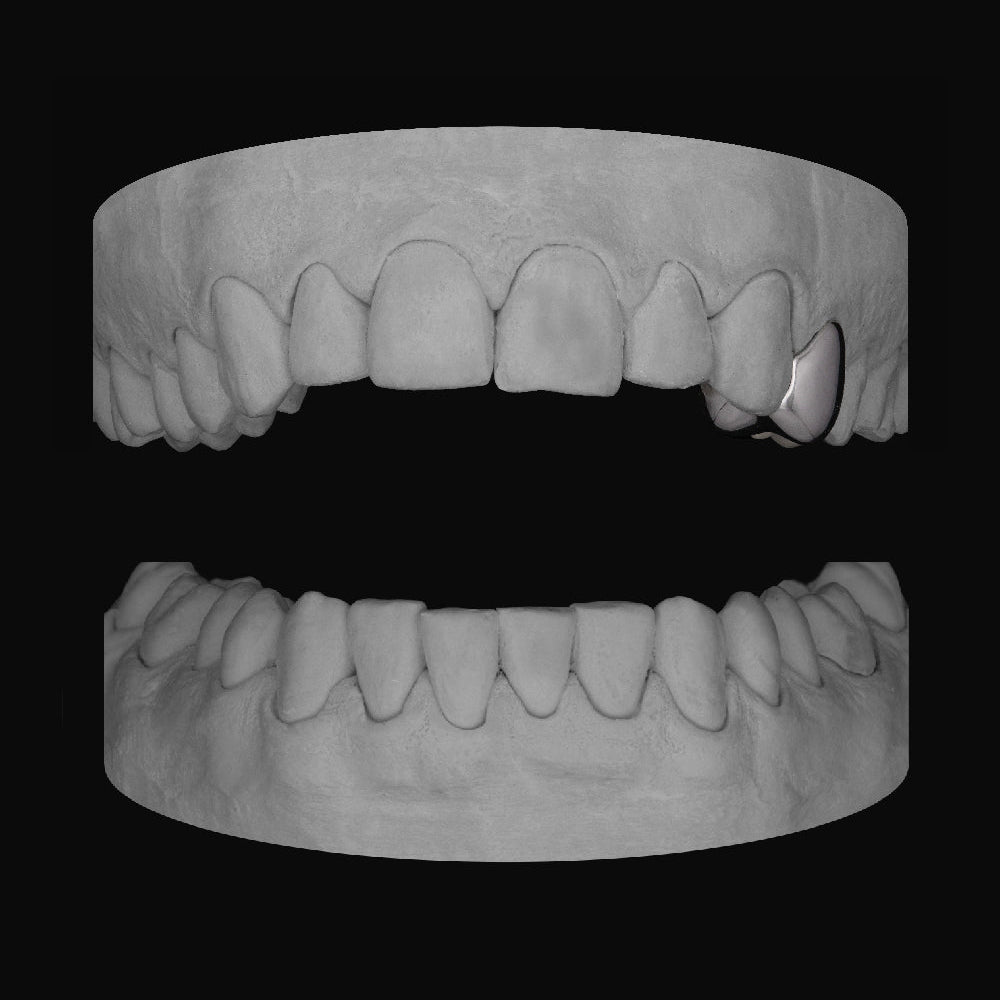 Premolar - Bitez Grillz