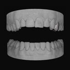 Premolar - Bitez Grillz
