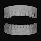Premolar - Bitez Grillz
