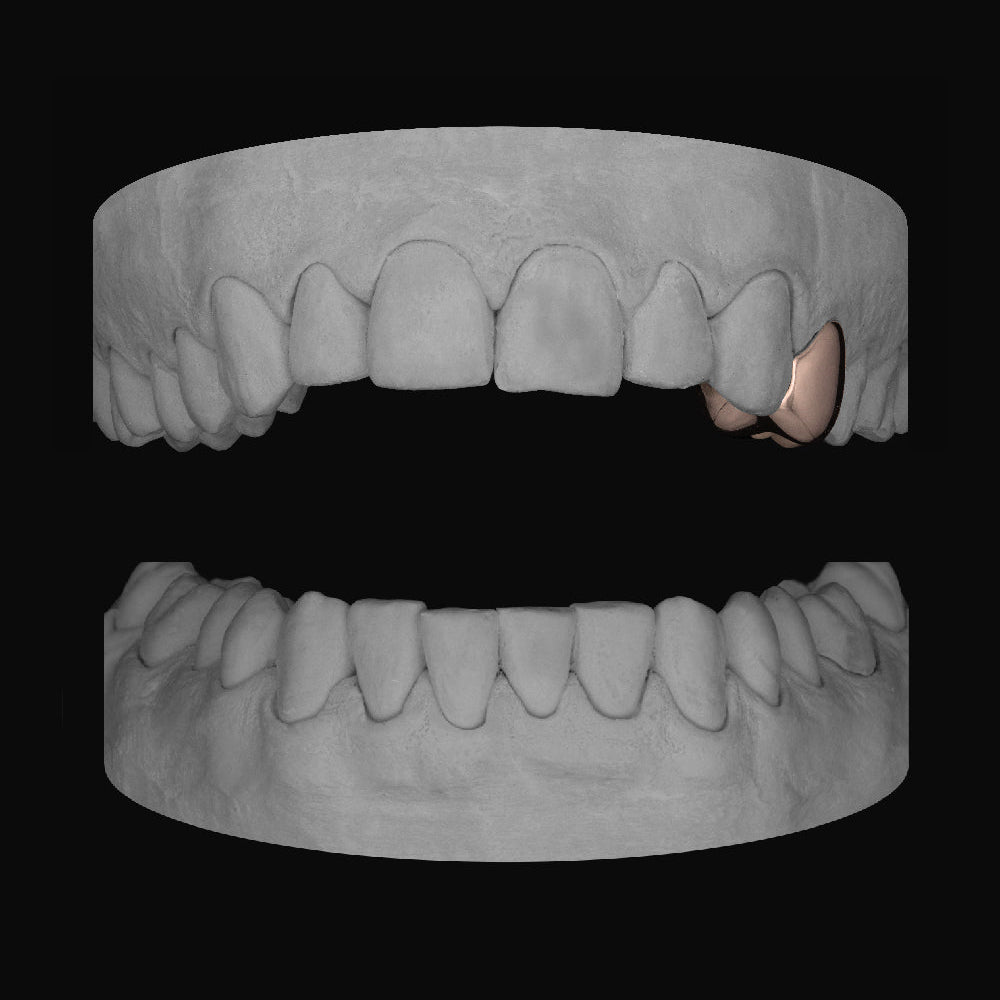 Premolar - Bitez Grillz
