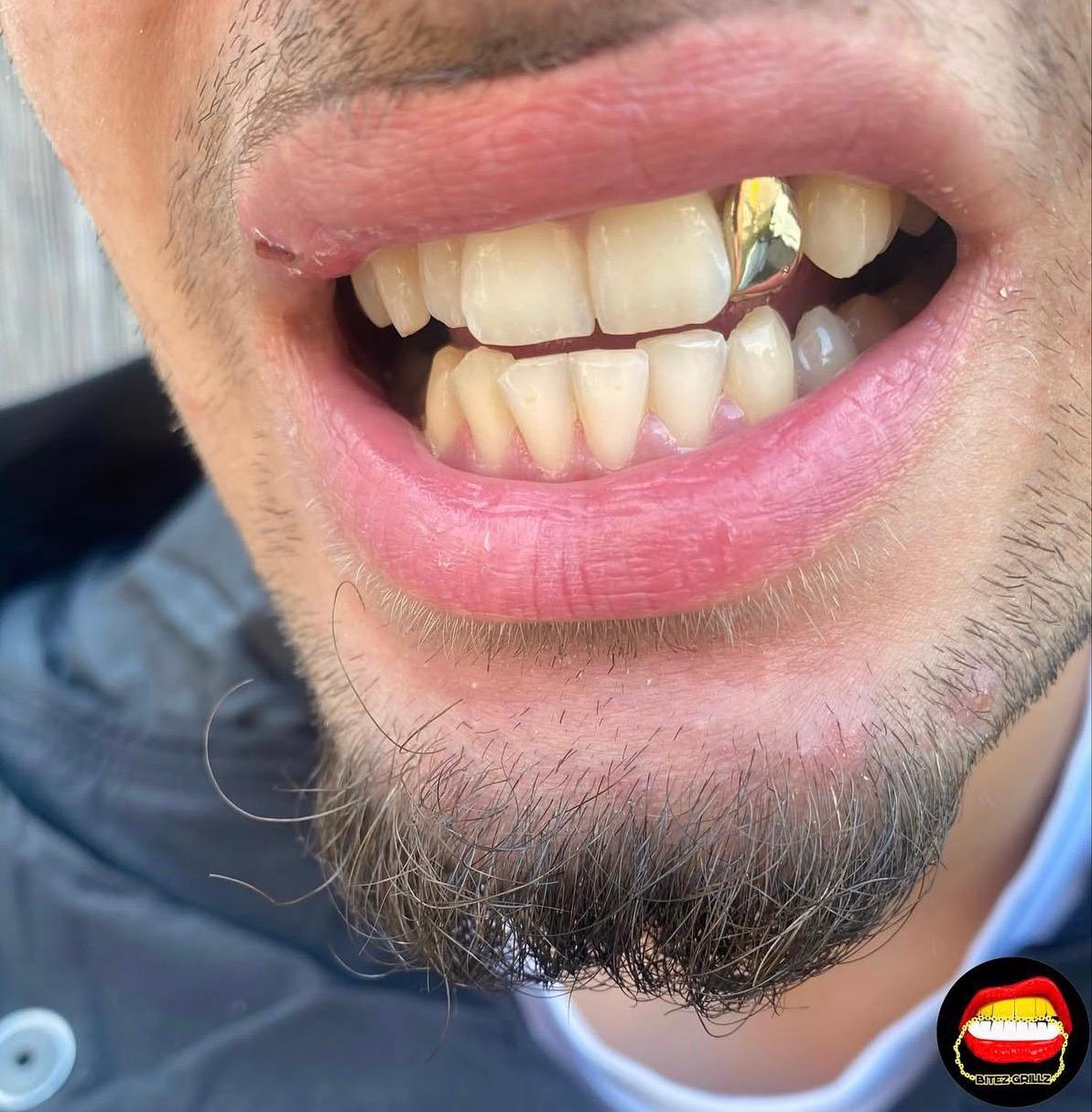 Lateral - Bitez Grillz