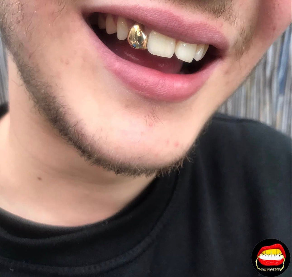 Lateral - Bitez Grillz