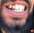 Lateral - Bitez Grillz