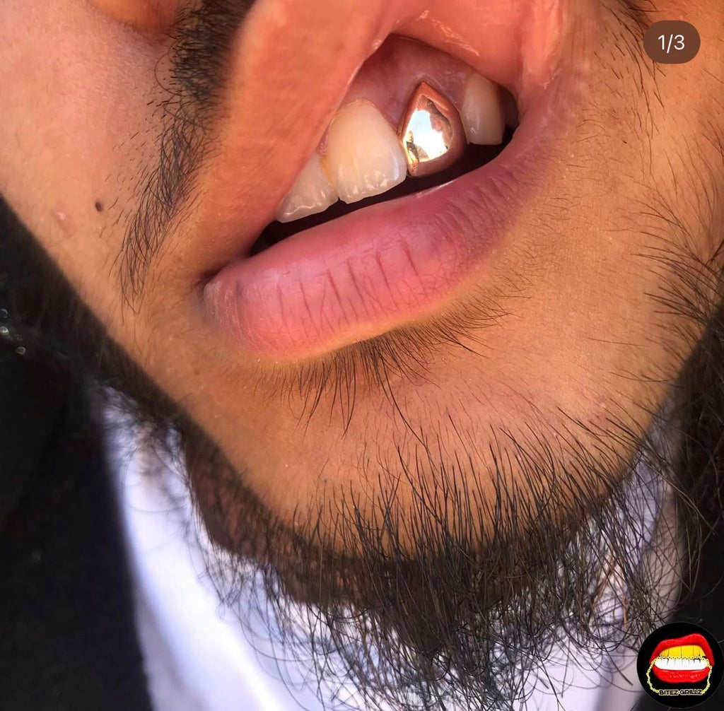 Lateral - Bitez Grillz