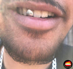 Lateral - Bitez Grillz