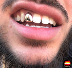 Lateral - Bitez Grillz