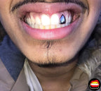 Lateral - Bitez Grillz