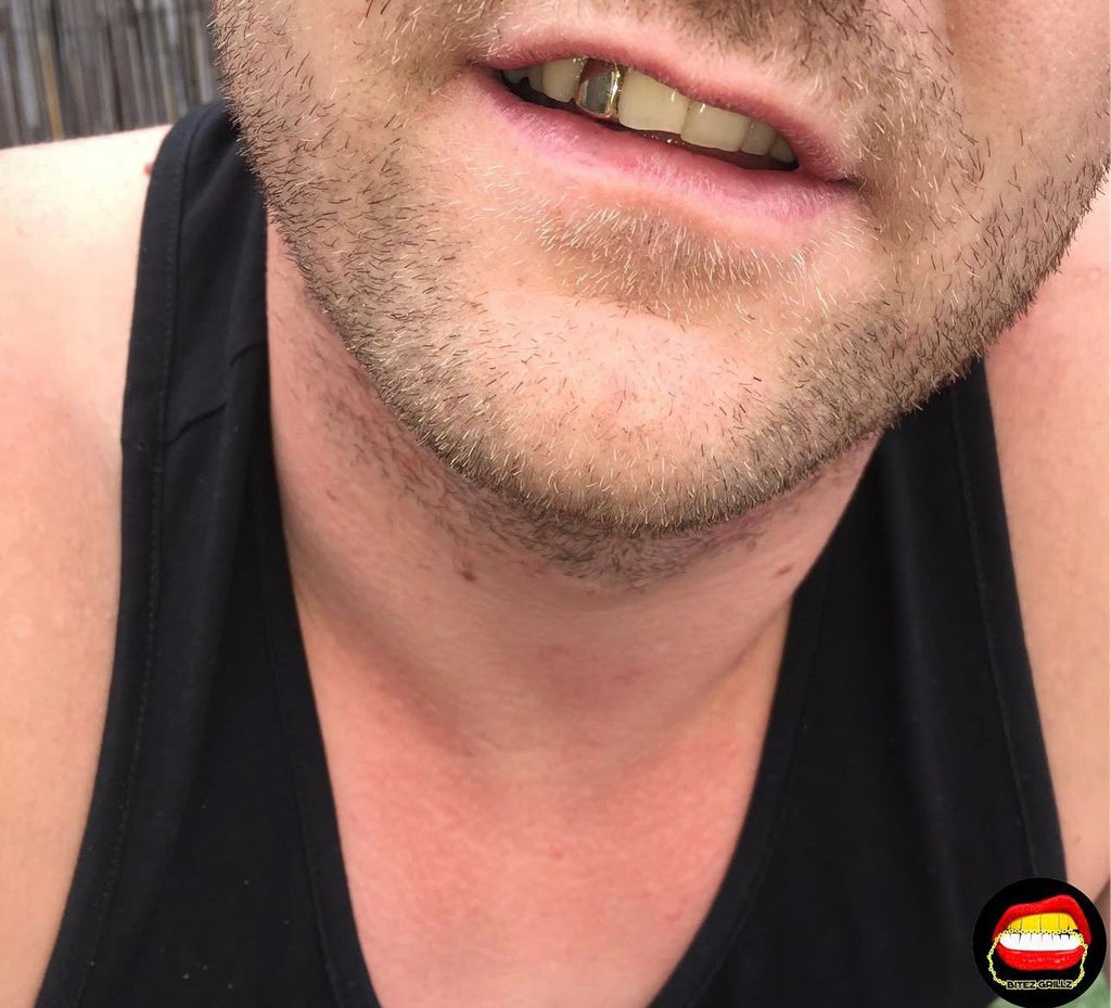 Lateral - Bitez Grillz