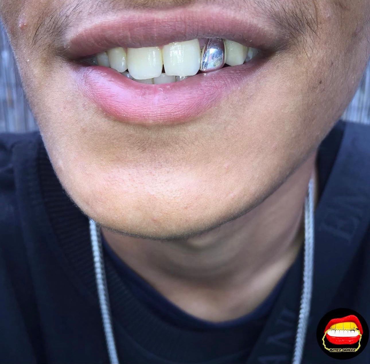 Lateral - Bitez Grillz