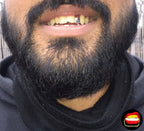 Lateral - Bitez Grillz