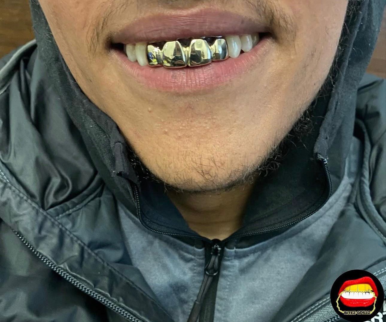 Top 4 Set - Bitez Grillz