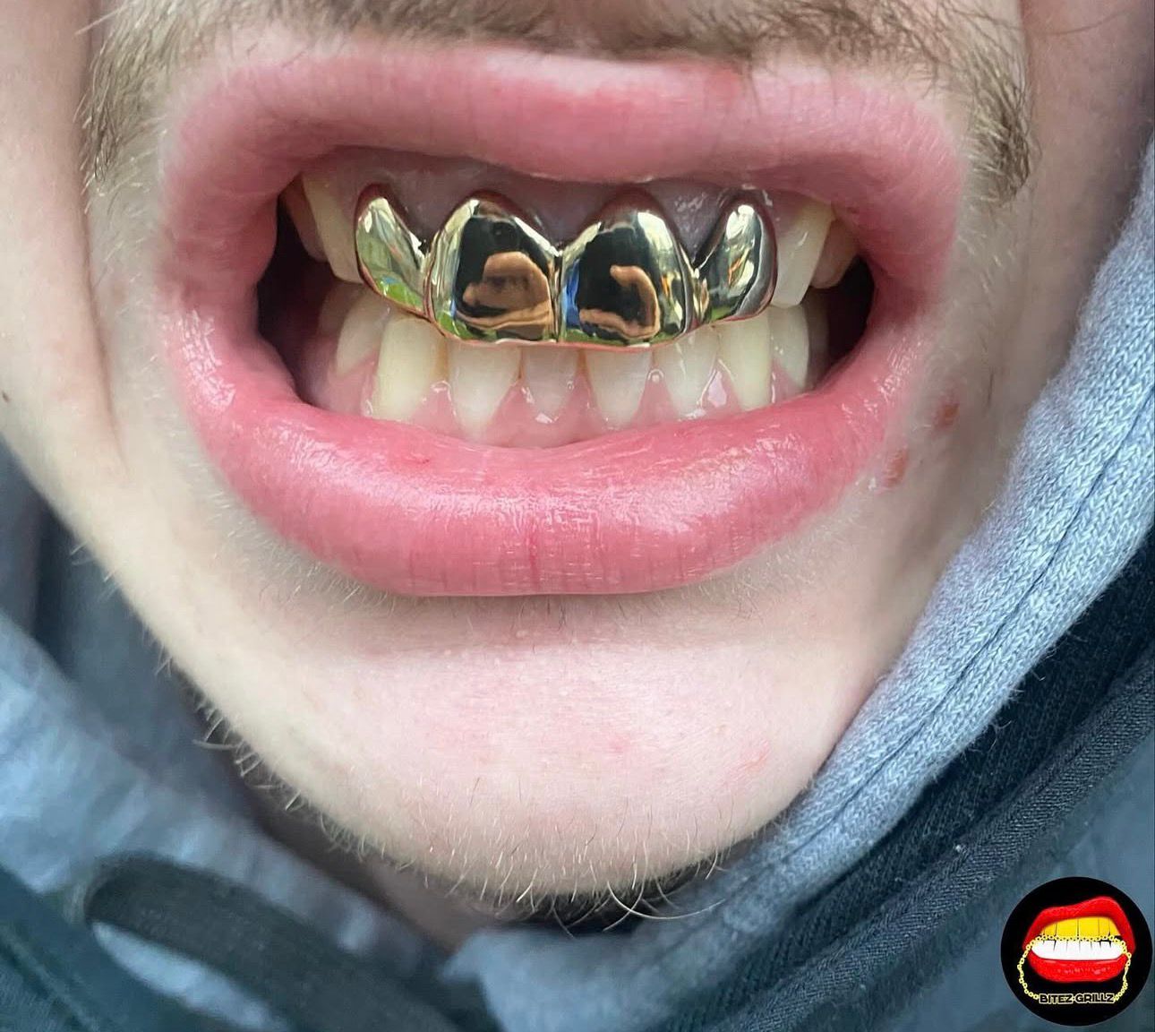 Top 4 Set - Bitez Grillz
