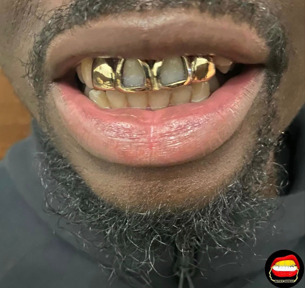 2 x Top Front Windows & Solid Laterals - Bitez Grillz