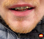 2 x Top Front Windows & Solid Laterals - Bitez Grillz