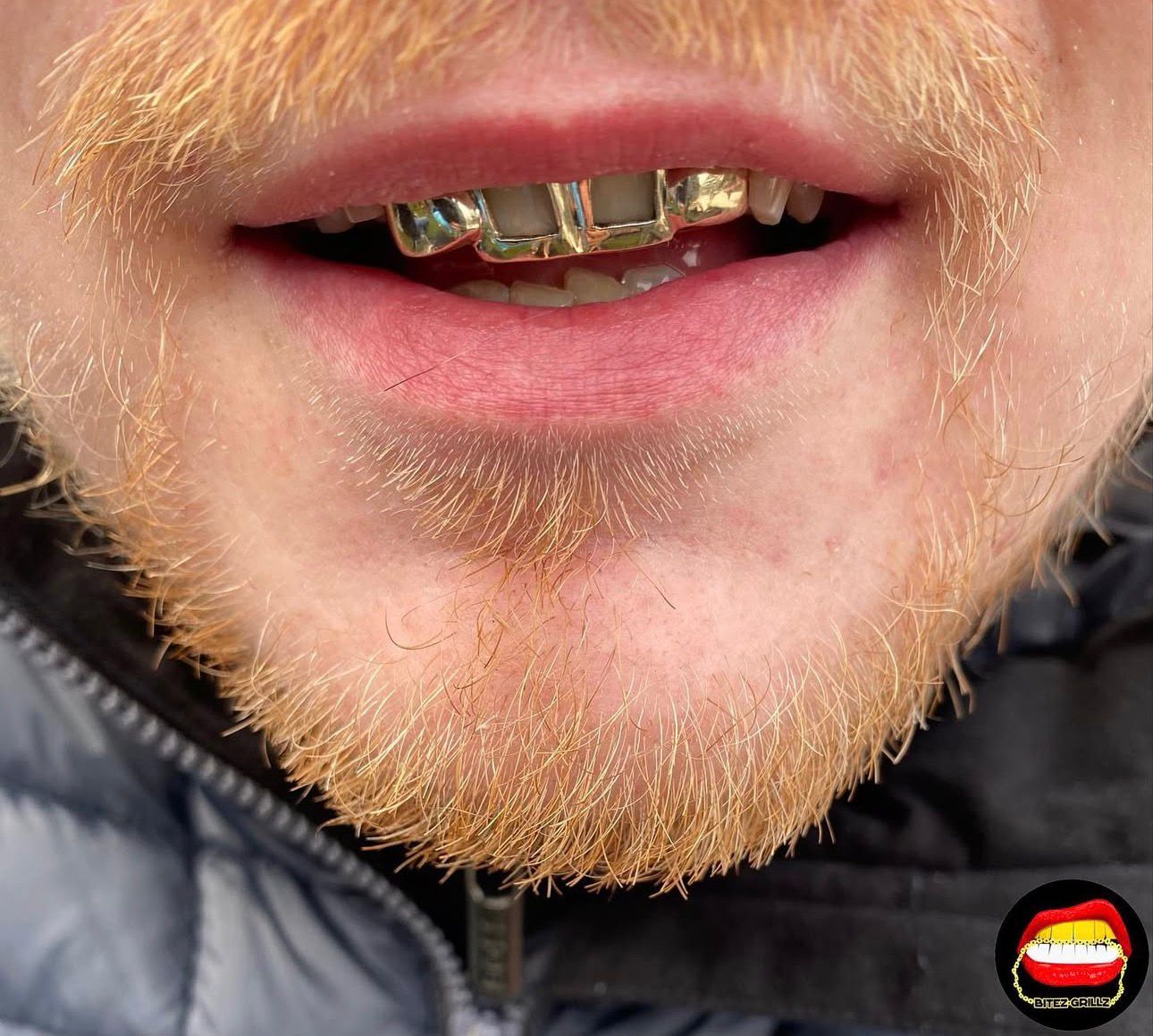 2 x Top Front Windows & Solid Laterals - Bitez Grillz