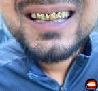 Top 4 Set - Bitez Grillz