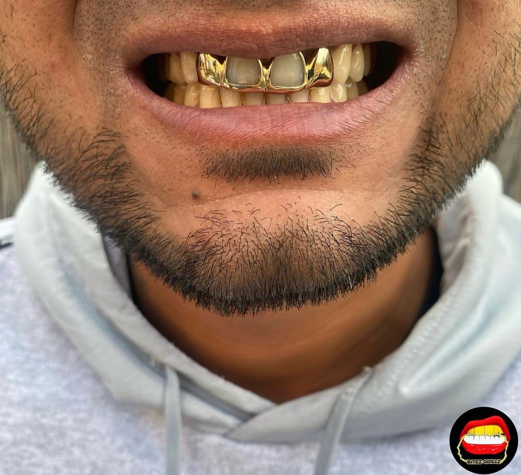 2 x Top Front Windows & Solid Laterals - Bitez Grillz