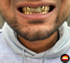 2 x Top Front Windows & Solid Laterals - Bitez Grillz
