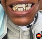 4 Laterals - Bitez Grillz