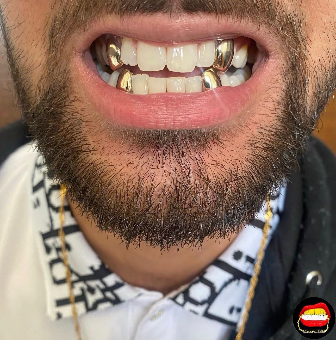 4 Canines - Bitez Grillz