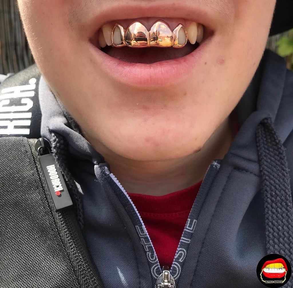 2 x Solid Fronts & 2 x Window Laterals - Bitez Grillz