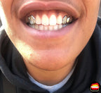 2 x Window Canine & 2 Solid Premolers - Bitez Grillz