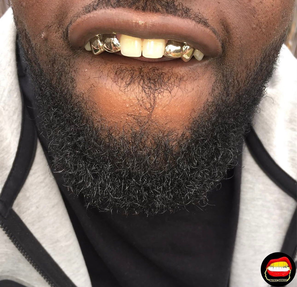 2 x Canine & Lateral - Bitez Grillz