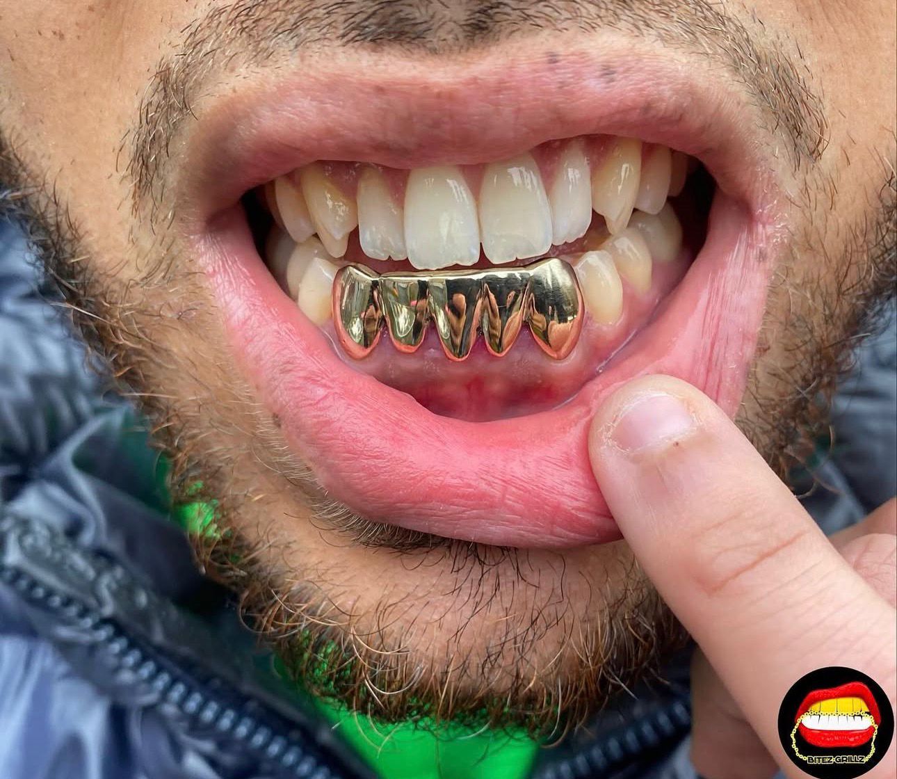 Bottom 5 Set - Bitez Grillz