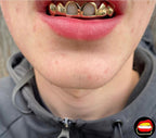 Top 6 Set with 4 Solids & 2 Windows - Bitez Grillz