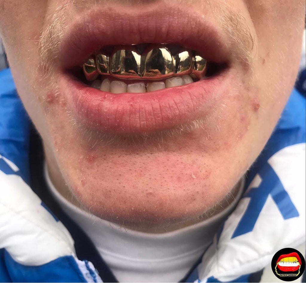 Top 6 - Bitez Grillz