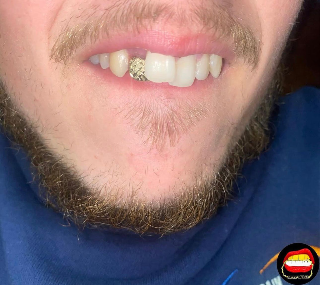 Lateral Diamond Dust Cut - Bitez Grillz