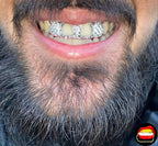 2 x Window Front & Lateral Diamond Dust Cut - Bitez Grillz