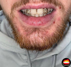 Lateral - Lateral Diamond Dust Cut - Bitez Grillz